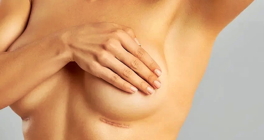 Por que tantas famosas estão removendo os implantes de silicone?